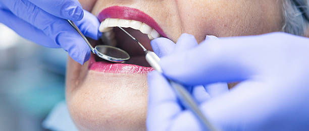 Best Emergency Treatment for Dental Infections or Abscesses in Dauphin Island, AL