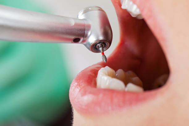 Best Emergency Treatment for Dental Infections or Abscesses in Dauphin Island, AL